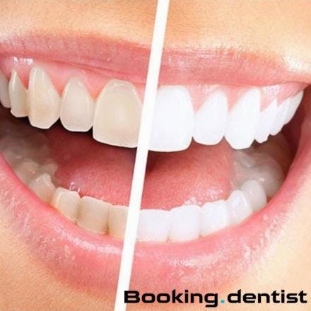 Home teeth whitening