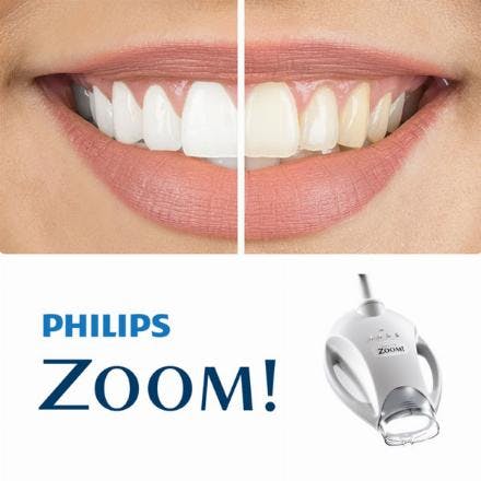 Zoom teeth whitening