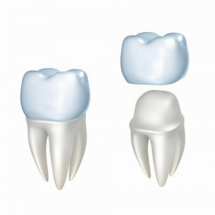 Full periodontal treatment